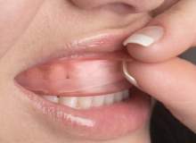 Diş beyazlatmanın diş hekimi tarafından yapılması gerekir?