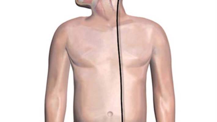 Çocuklarda Hidrosefali