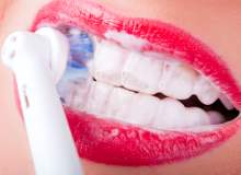 Beyazlatılan dişlerin bakımı nasıl yapılır?
