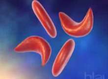 Akdeniz anemisi tedavisi Akdeniz anemisi tedavisi