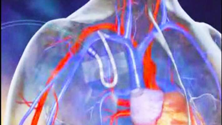 Akdeniz Anemisi Nedir?