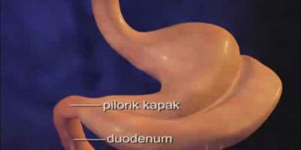 Pankreas Kanserinin Tedavisi