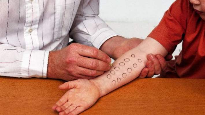 Alerji İlacı Ne Zaman Kullanılır?