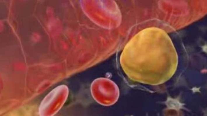 Löseminin Tedaviden Sonra Tekrarlama Riski