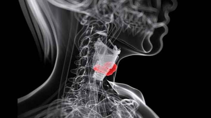 Gırtlak Kanserinin Radyoterapi İle Tedavisi