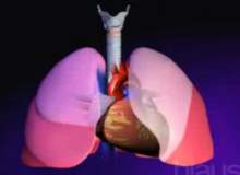Akciğer kanserinin tedavisi