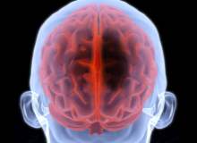 İyi huylu beyin tümörlerinin zararları