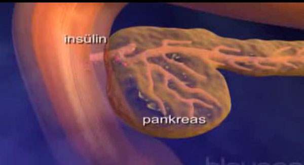 Pankreas Kanserinin Görüldüğü Kişiler