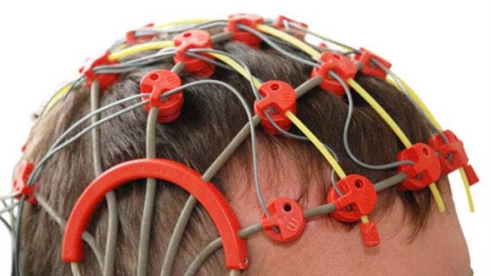 Yaygın Epilepsi Nöbeti