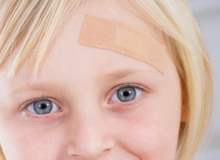 Beyin sarsıntısı geçiren çocukların takibi Beyin sarsıntısı geçiren çocukların takibi