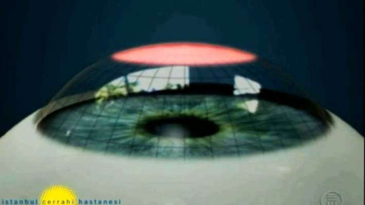 Gözle İlgili Yanlış Bilinen Doğrular