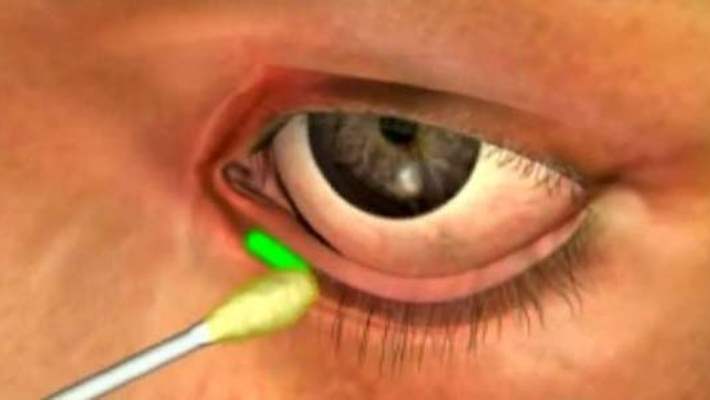 Göz Sağlığını Korumak İçin Bilmeniz Gerekenler