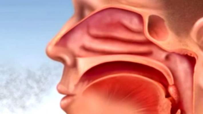 Bir Hapşırık Sizi Zatürree Edebilir