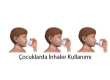 Astım çocuğunuzun yaşamını kısıtlamasın Astım çocuğunuzun yaşamını kısıtlamasın