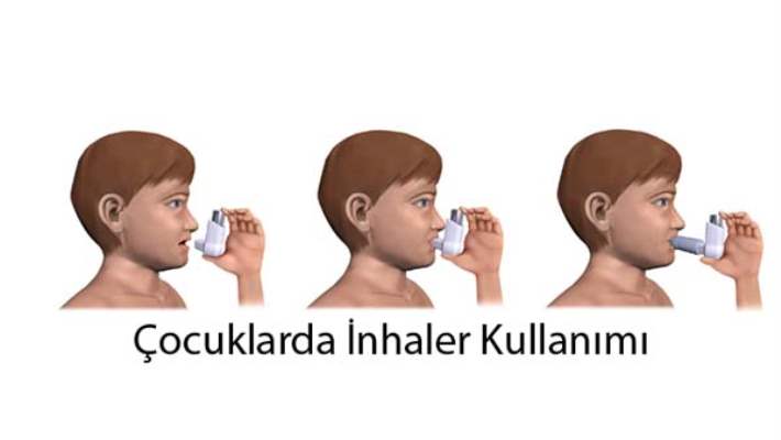 Astım Çocuğunuzun Yaşamını Kısıtlamasın
