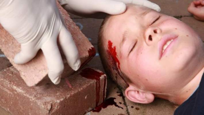 Baş Yaralanması Tedavisi