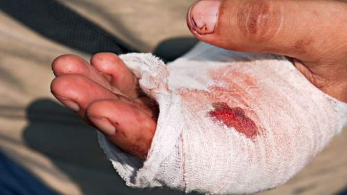 El Yaralanmaları Tedavisi