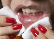 Aft Oluşumu Aft Oluşumu