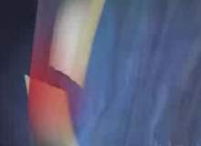 Bilek Kırıkları Bilek Kırıkları