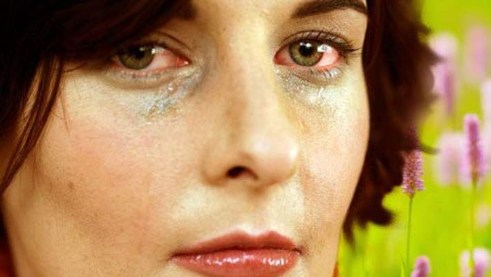 Botulinum Toksin (Botoks) Enjeksiyonu