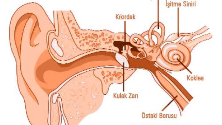 İç Kulak İltihaplanması