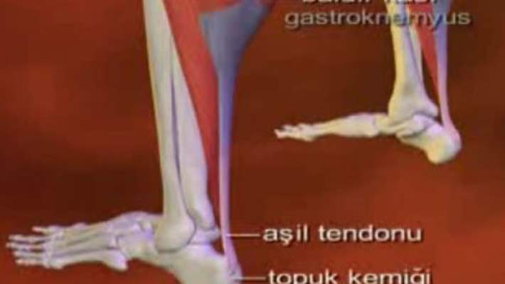 Tendon Kopmasi Tedavisi Hemen Saglik Tendon Kopmasi Tedavisi Hemen Saglik