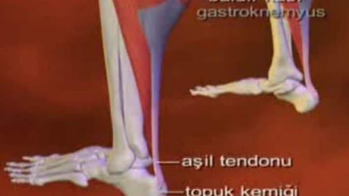 Tendon Kopması Tedavisi