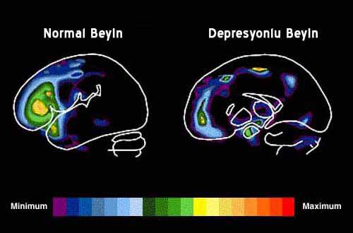 Genel Olarak Depresyon