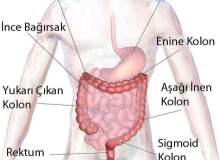 Divertiküloz Divertiküloz