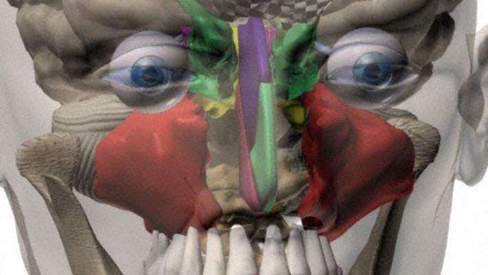 Kafa İçi Kanamalar