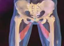 Kalça Labrum Yırtığı Kalça Labrum Yırtığı