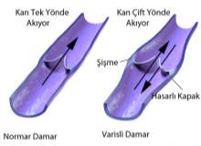 Varisli Toplar Damarlar Varisli Toplar Damarlar
