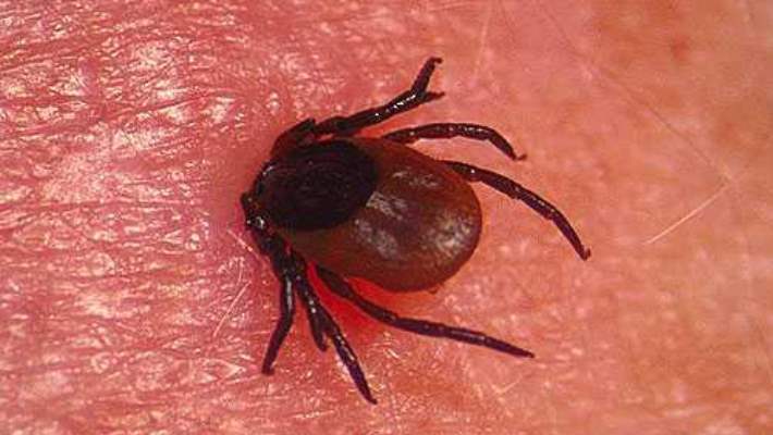 Lyme Hastalığı: Nedenleri, Belirtileri Ve Tedavisi