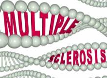 Multipl Skleroz (MS) Multipl Skleroz (MS)