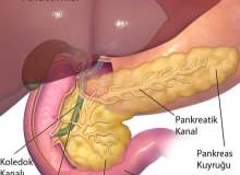 Pankreas Kanseri Pankreas Kanseri
