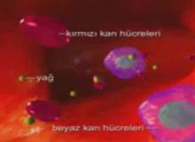 Orak Hücre Hastalığı Orak Hücre Hastalığı