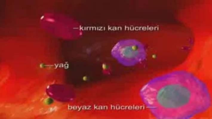 Orak Hücre Hastalığı