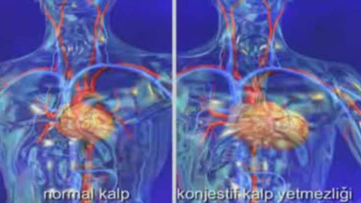 beslenme ve konjestif kalp yetmezligi hemen saglik