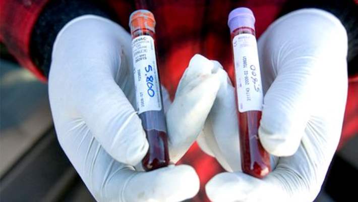 Trigliserit/Diyabet Bağlantısı