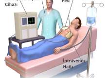 Kardiyoversiyon Kardiyoversiyon