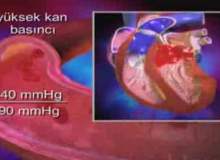 Yüksek Tansiyon Sertleşme Bozukluğuna Nasıl Yol Açar Yüksek Tansiyon Sertleşme Bozukluğuna Nasıl Yol Açar