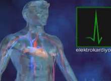 Elektrokardiyogram Elektrokardiyogram