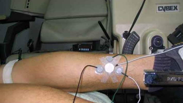 Elektromiyografi (Emg)