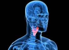 Gırtlak Kanseri Gırtlak Kanseri