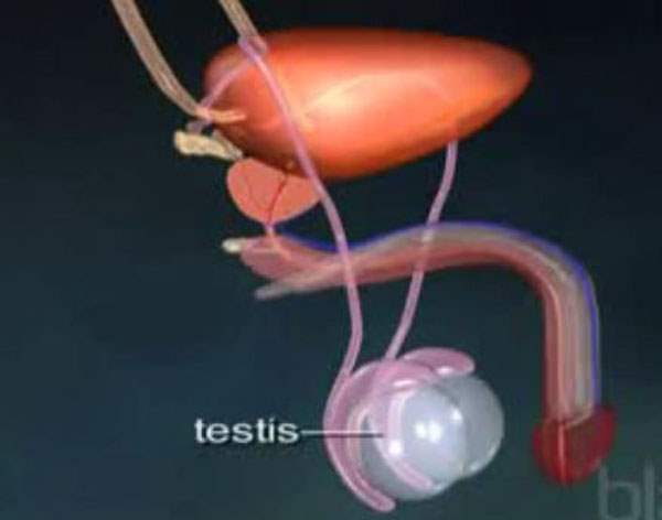 Testis Kanseri