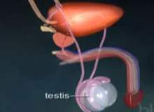 Testis Kanseri Testis Kanseri