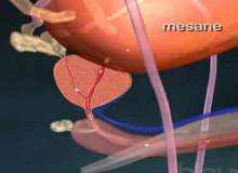 Mesane Kanseri Mesane Kanseri