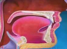 Ağız Kanseri Ağız Kanseri