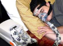 Merkezi Uyku Apnesi Merkezi Uyku Apnesi