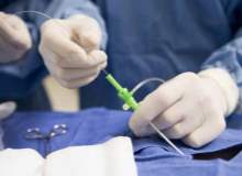 Koroner Anjiyogram Koroner Anjiyogram